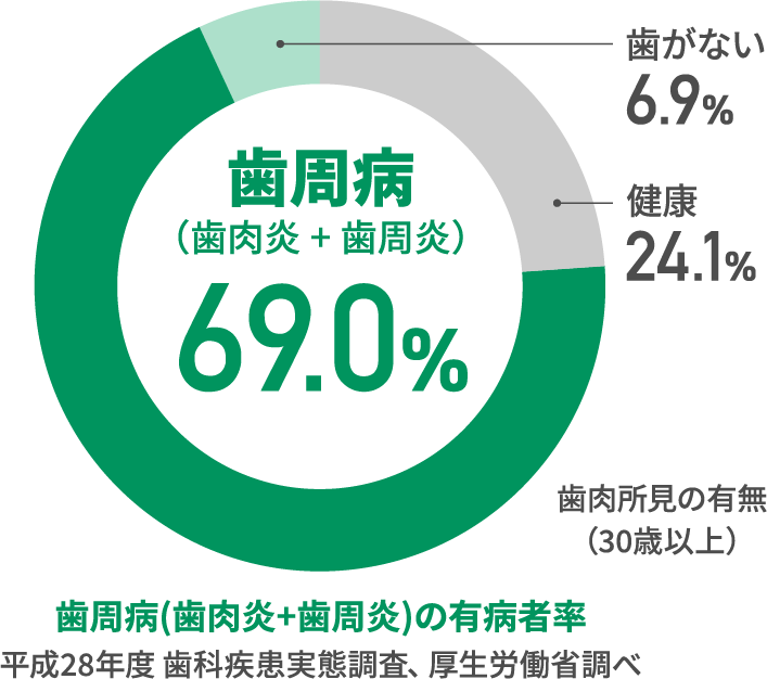歯周病 (歯肉炎+歯周炎) 69.0% 歯がない 6.9% 健康 24.1% 歯肉所見の有無 (30歳以上) 歯周病(歯肉炎+歯周炎)の有病者率 平成28年度歯科疾患実態調査、厚生労働省調べ