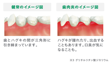 イメージ図