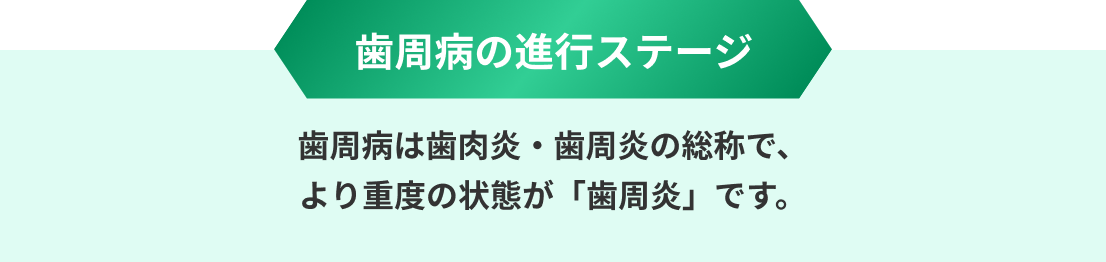 歯周病の進行ステージ 歯周病は歯肉炎・歯周炎の総称で、より重度の状態が「歯周炎」です。