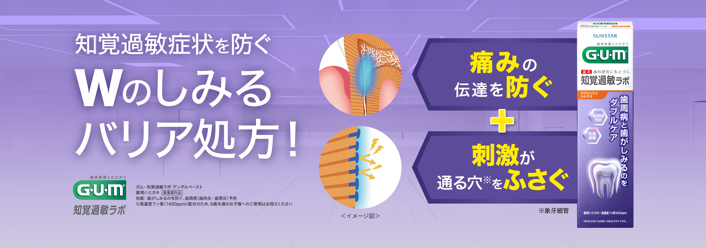 知覚過敏症状を防ぐWのしみるバリア処方！